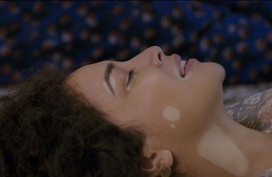 This Bollywood movie celebrates the inner beauty by normalizing vitiligo 1 Bollywood movie Kuch Bheege alfaaz Vitiligo